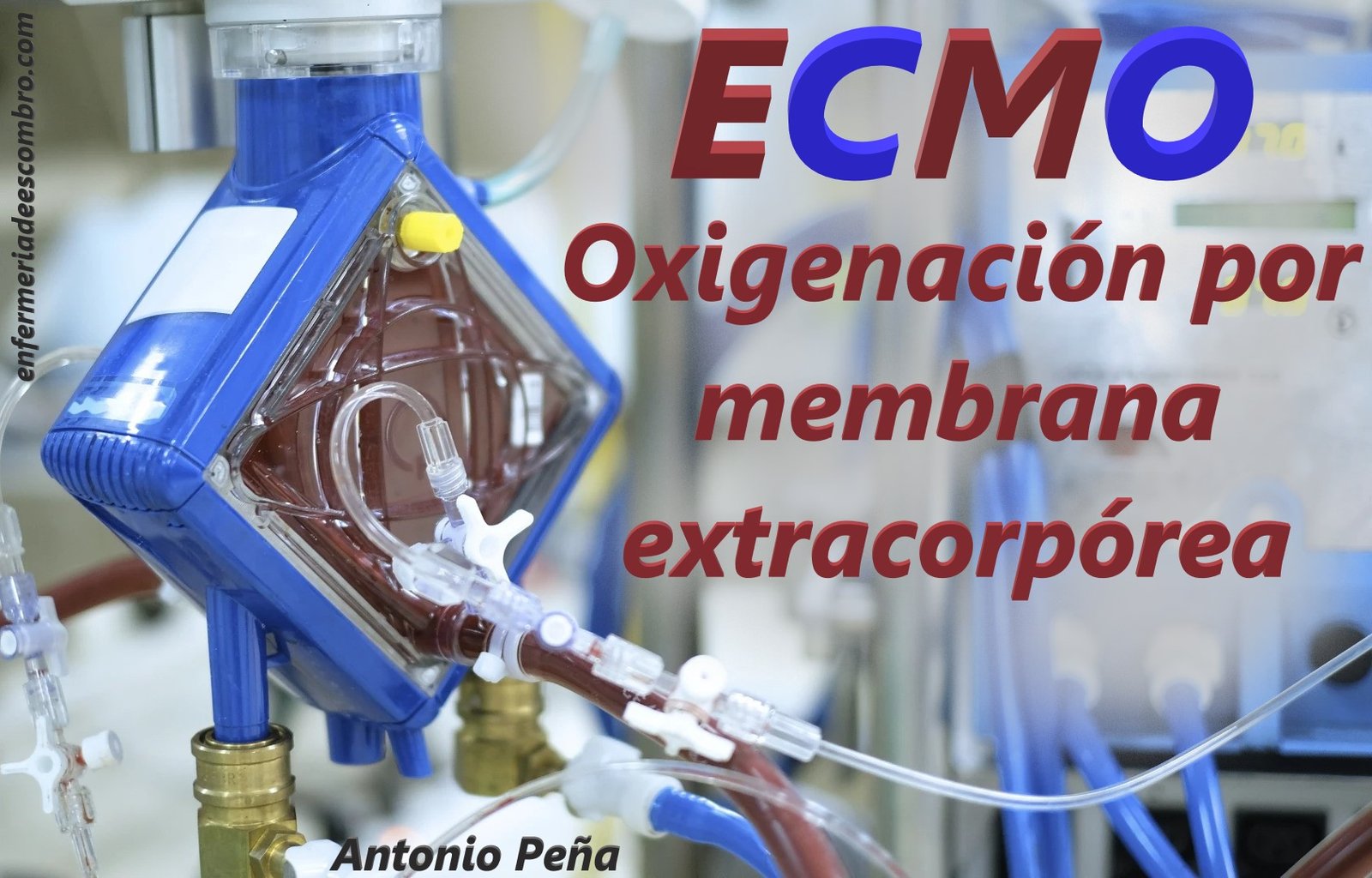 ECMO Oxigenación por membrana extracorpórea